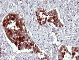 SERPINB3 Antibody (clone OTI1G1)