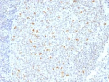 BCL6 Antibody (clone BCL6/1526, Azide-free, BSA-free)