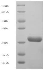Human NFYB Protein (Recombinant GST, N-terminus)