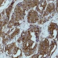 PathPlus™ CANX / Calnexin Antibody