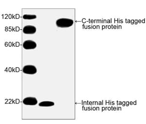 His Tag Antibody (His epitope)