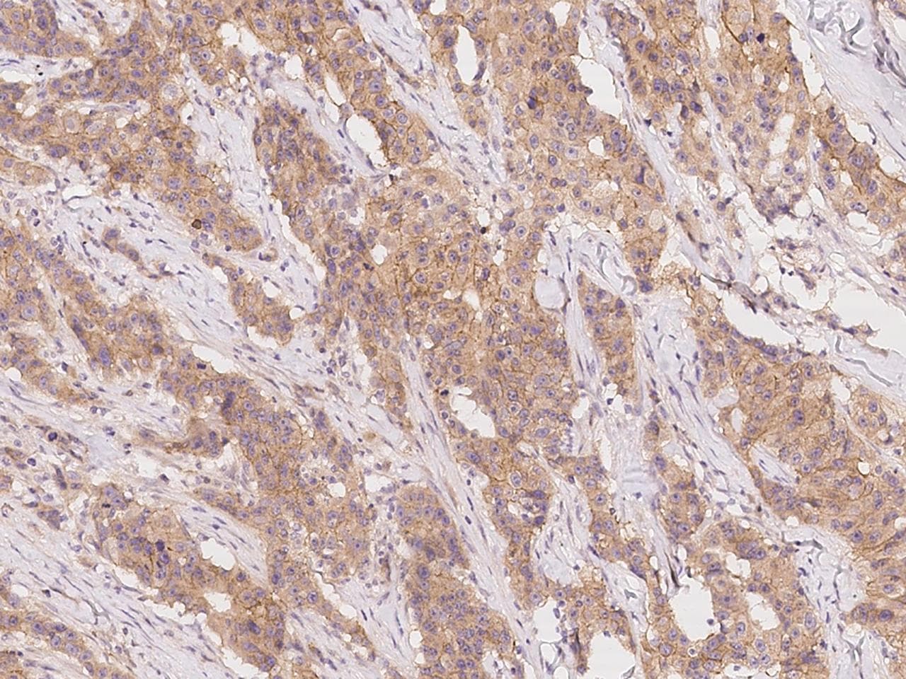 SLC44A1 / CD92 Antibody