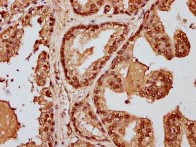 HIST1H3A Antibody