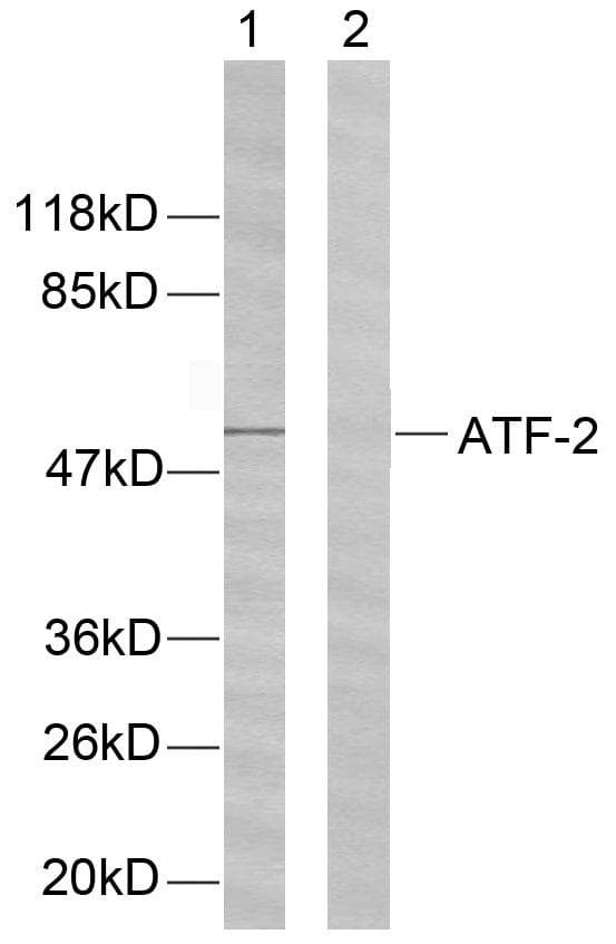 Polyclonal Rabbit anti-Human ATF2 Antibody (p62 or 44, IHC, IF, WB)