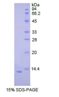 Human CDH2 / N Cadherin Protein (Recombinant His)