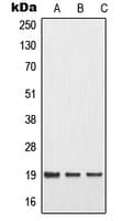 MMP1 Antibody (Internal)