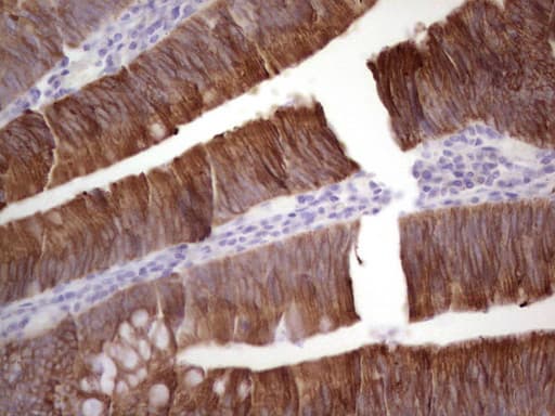 Monoclonal Mouse anti-Human Acidic Cytokeratin AE1 Antibody (clone AE1, IHC)