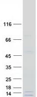 Human GATC Protein (Recombinant Myc-DDK (Flag))