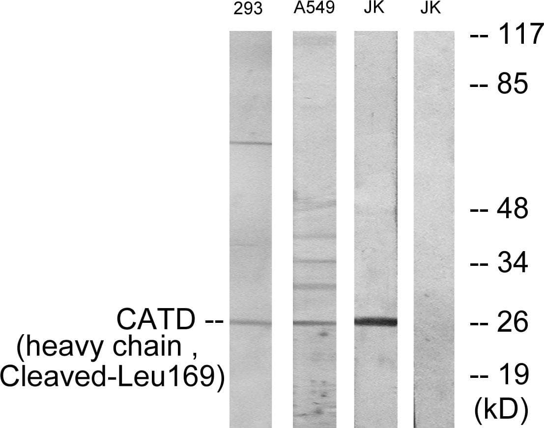 CTSD / Cathepsin D Antibody (heavy chain, Cleaved-Leu169)