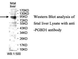 PGBD1 Antibody (aa70-332)