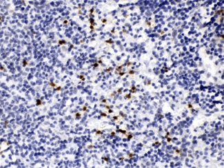 MMP9 / Gelatinase B Antibody