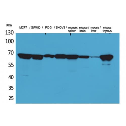 LMNB1 / Lamin B1 Antibody (381-430 aa, Internal)