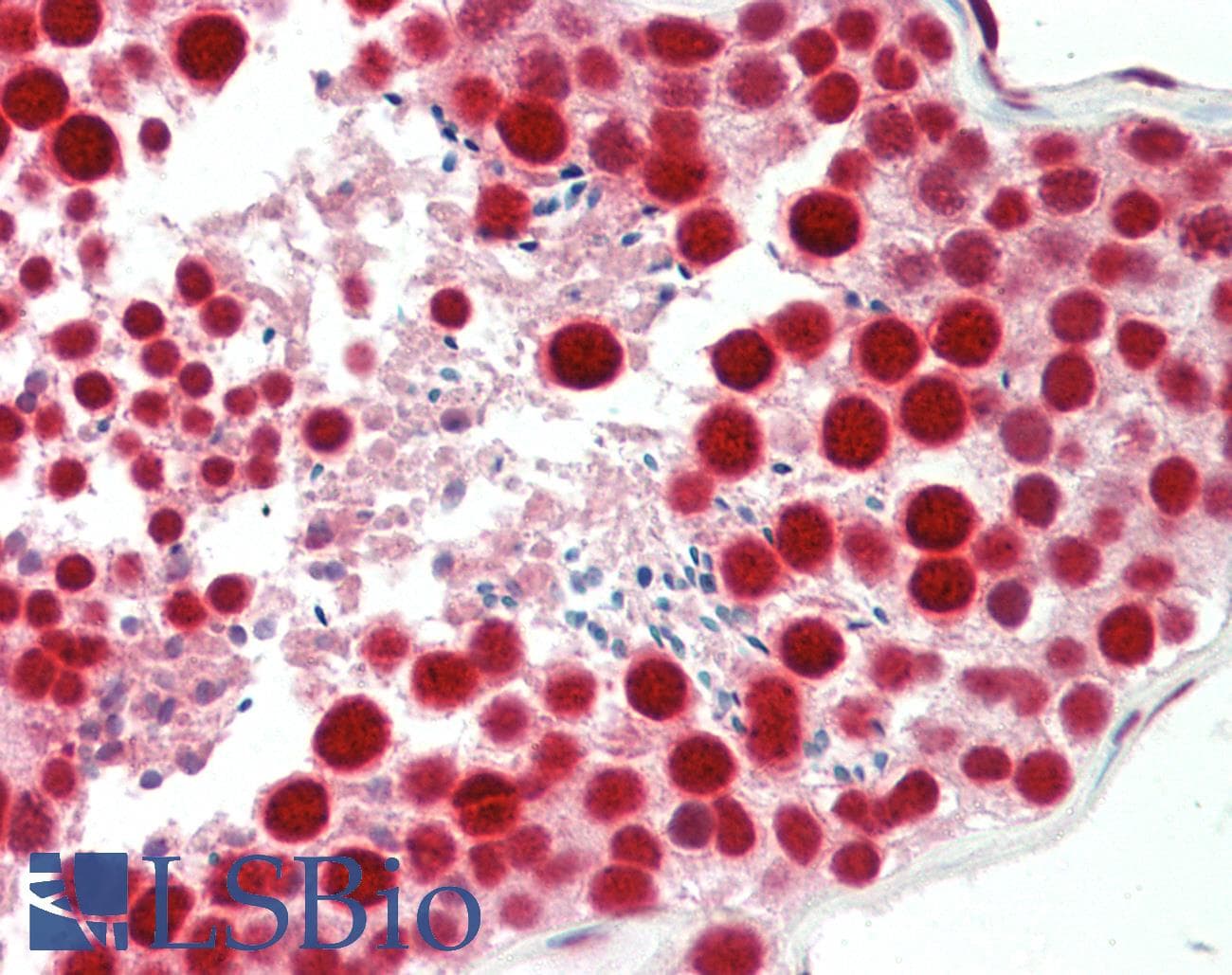 PathPlus™ TDP-43 / TARDBP Antibody (aa1-30)