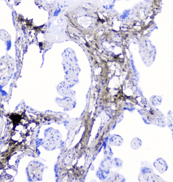 Lumican Antibody