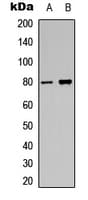 PRKCA / PKC-Alpha Antibody (C-Terminus)