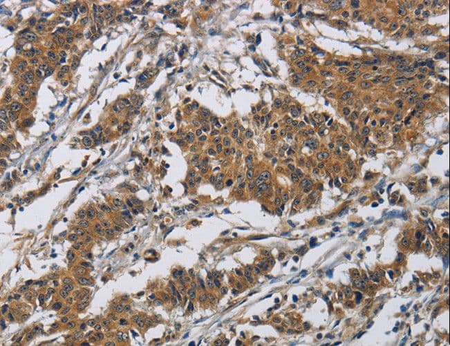 CLDN8 / Claudin 8 Antibody