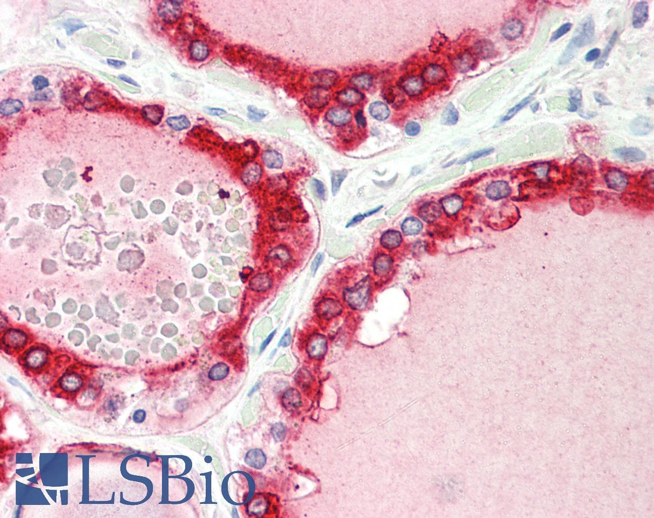 PathPlus™ TPO / Thyroid Peroxidase Antibody (aa850-C-term)