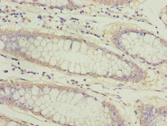 Polyclonal Rabbit anti-Human ATL2 Antibody (IHC, WB)