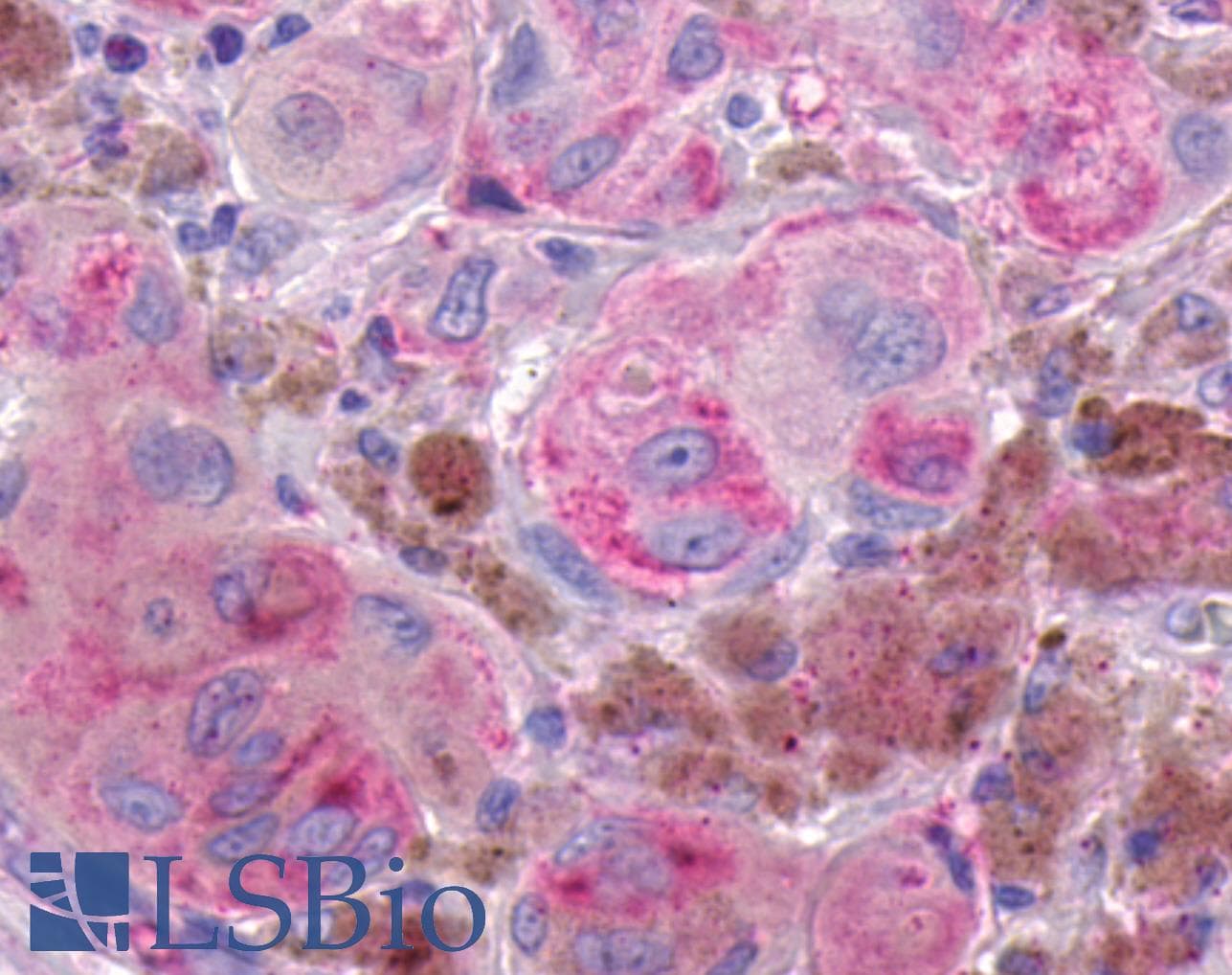 PathPlus™ GPR161 Antibody (N-Terminus)