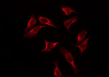 RPS2 / Ribosomal Protein S2 Antibody