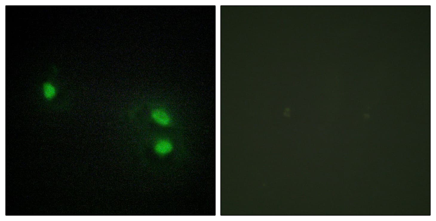 IHC-plus™ Polyclonal Rabbit anti-Human Histone H2B Antibody (aa1-50, IHC, IF, WB)