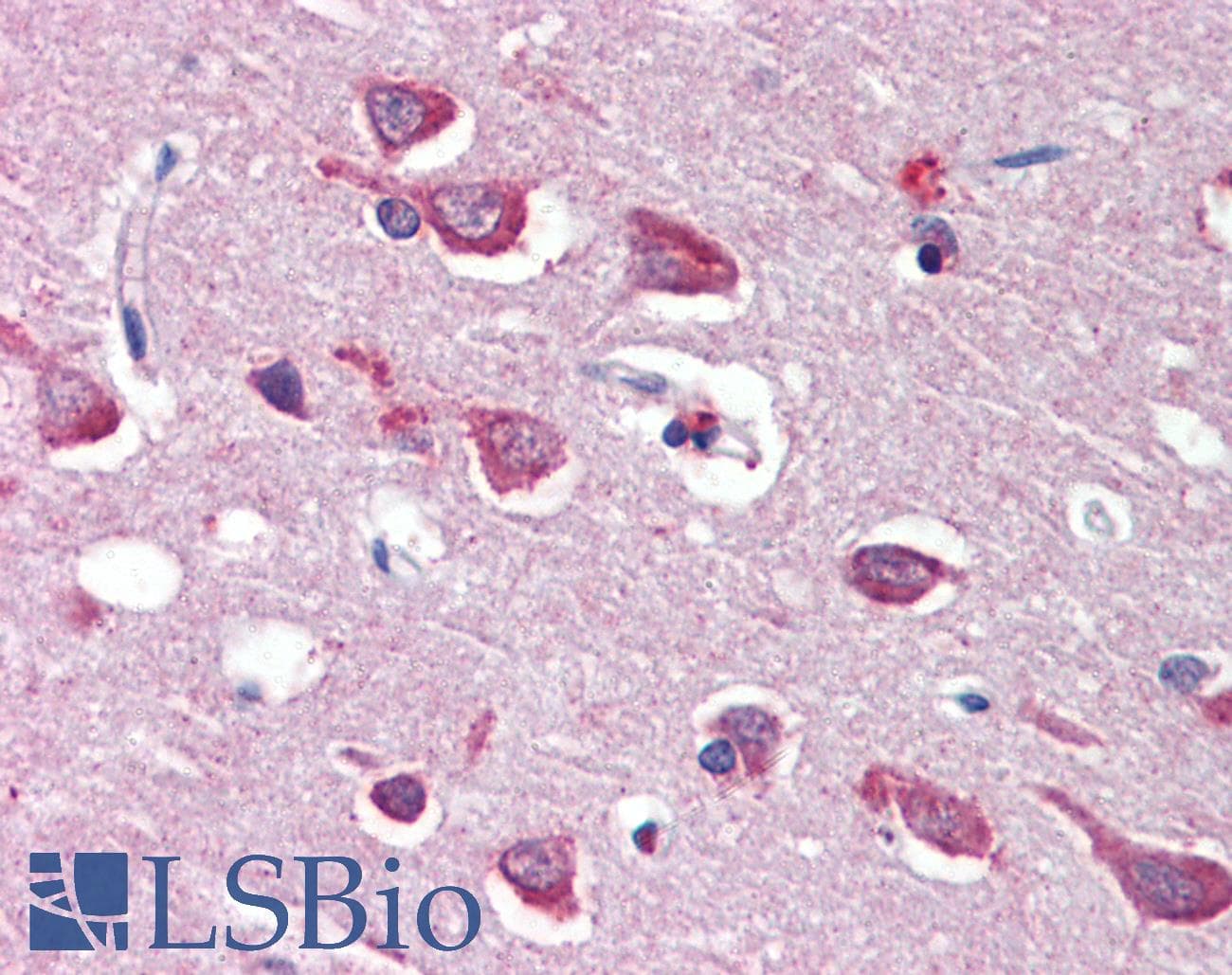 IHC-plus™ GRIA4 / GLUR4 Antibody (aa279-292)