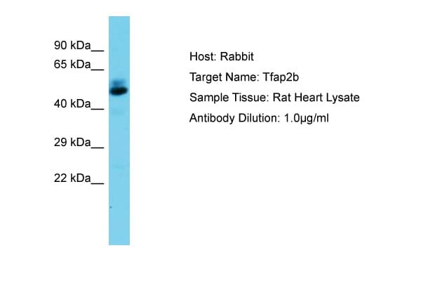 TFAP2B / AP2 Beta Antibody (aa104-153)