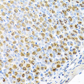 FECH / Ferrochelatase Antibody