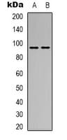 Polyclonal Rabbit anti-Human SEMA4D / Semaphorin 4D / CD100 Antibody (N-Terminus, WB)