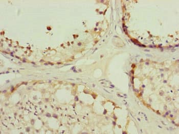 Polyclonal Rabbit anti-Human TOMM34 Antibody (IHC, WB)