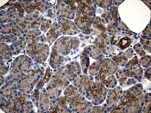 Monoclonal Mouse anti-Human NFKBIE / IKB Epsilon Antibody (clone OTI6H8, Carrier-free, IHC, WB)