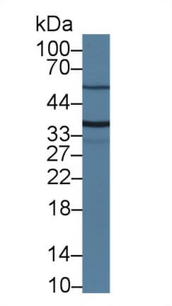TMPRSS2 / Epitheliasin Antibody (aa254-490, Biotin)