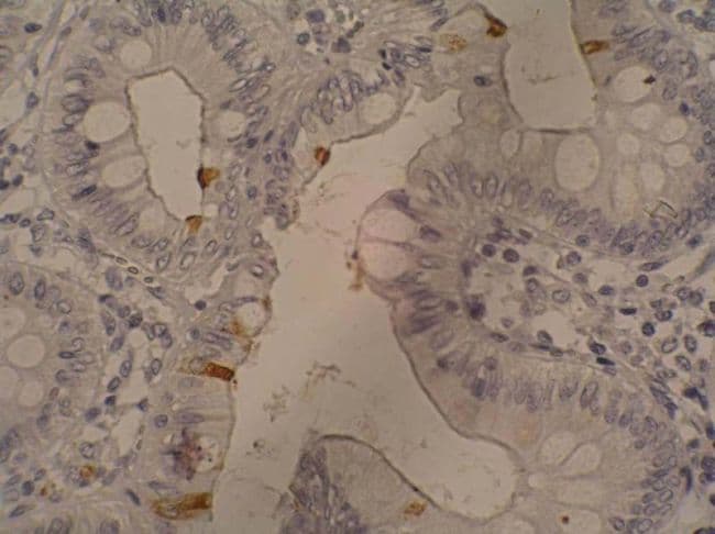 Monoclonal Mouse anti-Human Sialylated Lewis a / CA 19-9 Antibody (clone 121SLE, IHC)