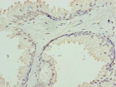 GNA14 Antibody