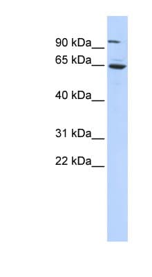 FOXJ3 Antibody (C-Terminus)