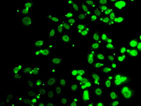 HFip1 / FIP1L1 Antibody