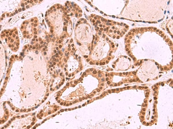 MCMBP / C10orf119 Antibody