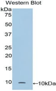 SCGB1A1 / Uteroglobin Antibody (aa21-96)