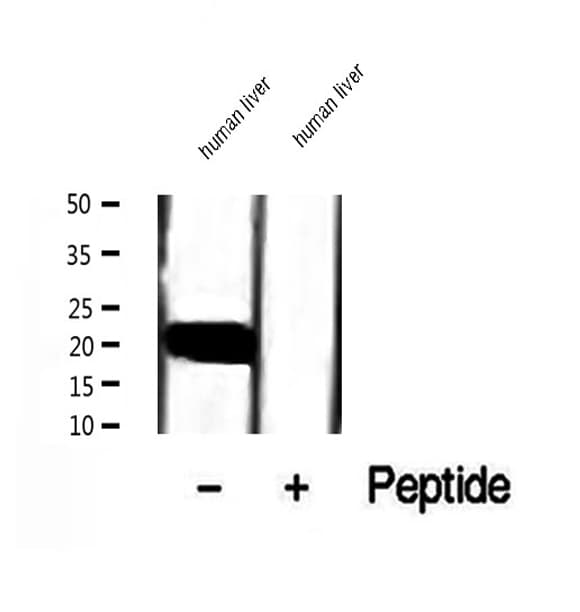 COMMD1 Antibody