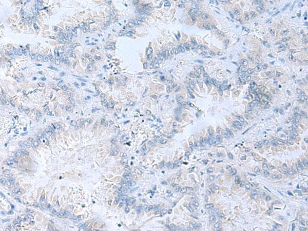 ATP6V1C1 Antibody