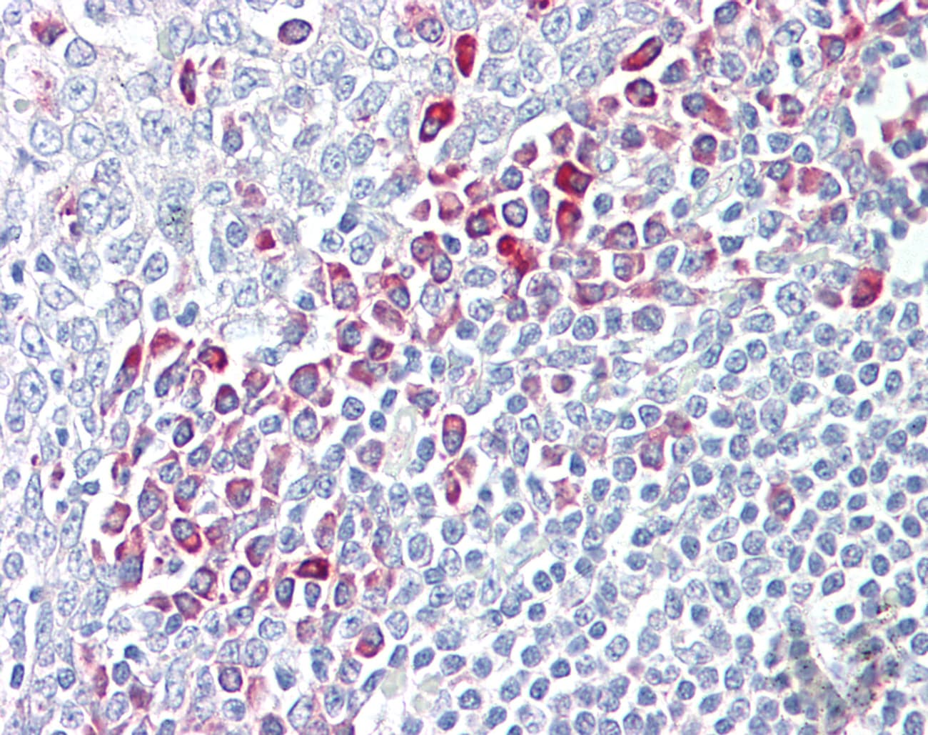 PARP6 Antibody (aa431-480)