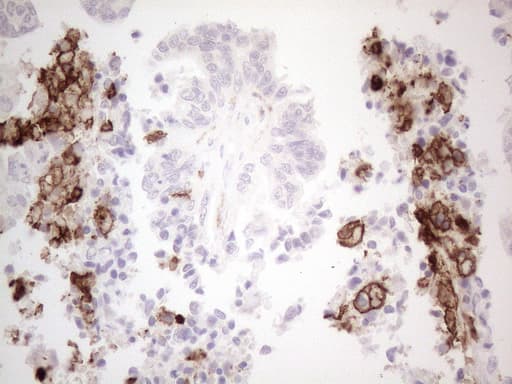 ITGAM / CD11b Antibody (clone OTI12C10)