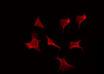 KLF11 Antibody