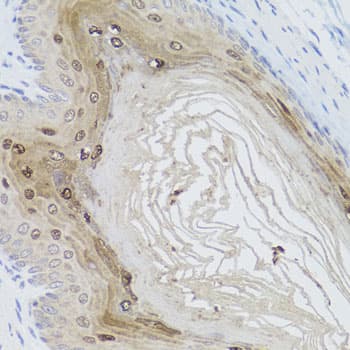 Polyclonal Rabbit anti-Human AMBRA1 Antibody (IHC, WB)