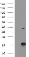 ATXN7L1 Antibody (clone OTI4F6)