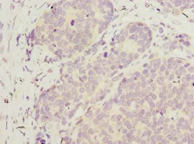 WDR89 Antibody