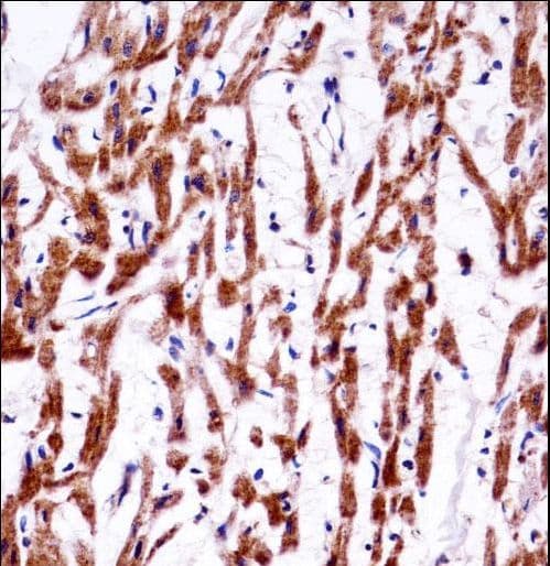TMEM85 Antibody (aa34-62)
