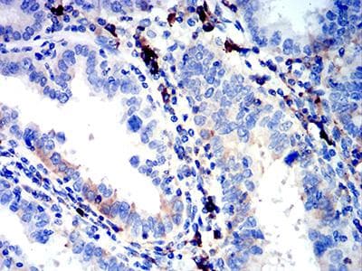IGLC2 Antibody (clone 5E12B9)