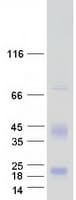 Human ID4 Protein (Recombinant Myc-DDK (Flag))