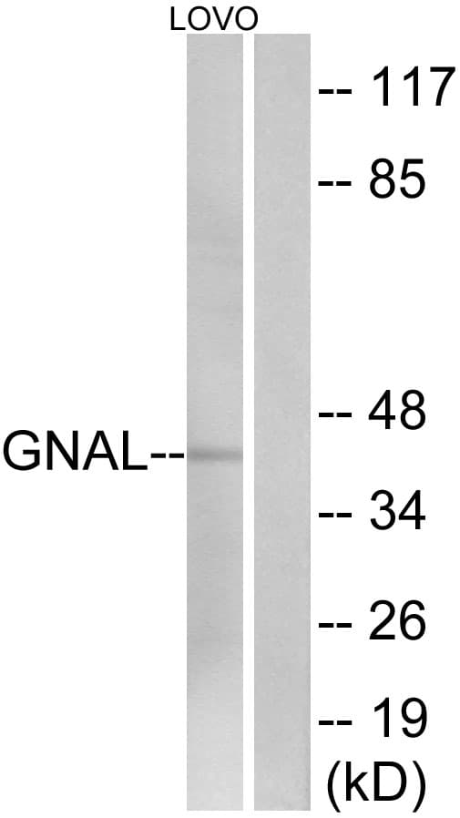 GNAL Antibody (aa41-90)